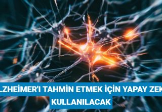 Bilim insanları, Alzheimer’ı tahmin etmek için 1 milyondan fazla beyni analiz edecek